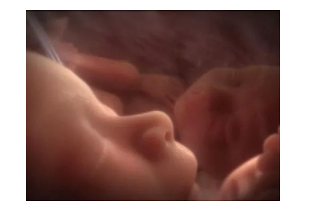 微信截图_20180601155623.png